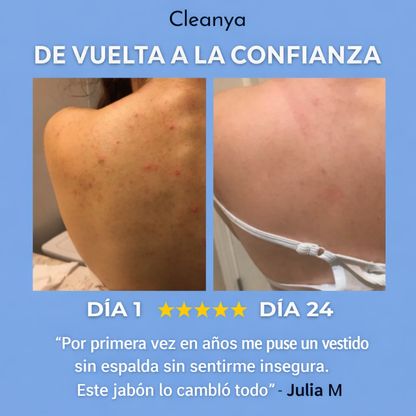 Jabón Anti Acné - Cleanya™